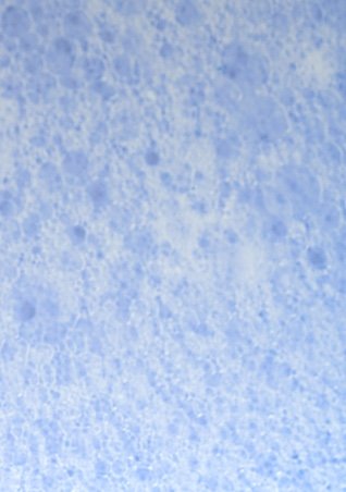https://www.laroche-posay.sk/-/media/project/loreal/brand-sites/lrp/emea/tsh/oncology/during-hairloss/lrp-oncology-2021-sitecore-during-during_hair_loss-flipcard6.jpg