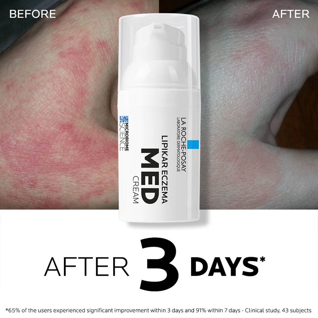 lrp-lipikar-eczema-med-3337875771214-Beforeafter2
