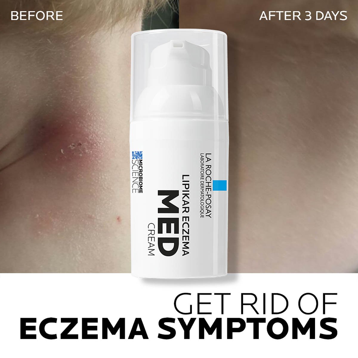 lrp-lipikar-eczema-med-3337875771214-Beforeafter3
