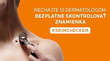 Skinchecker banner image mobile sk